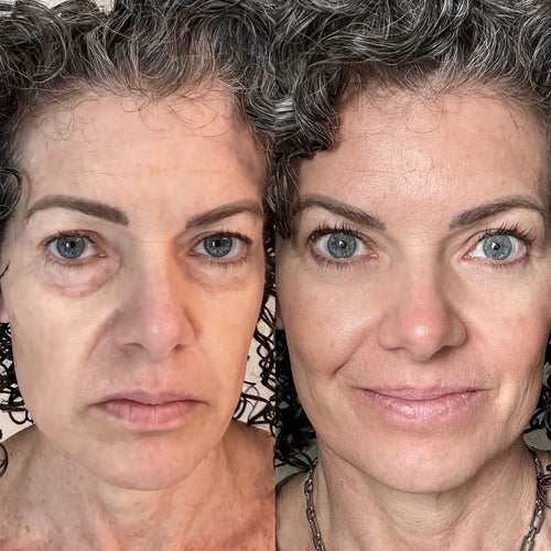 Finally wake up without the puffiness. No creams. No filters.